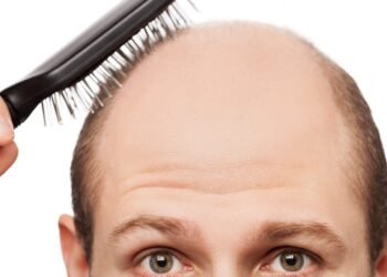 بشرى للمصابين بالصلع.. علماء يبتكرون علاجا جديدا قد ينهي المشكلة