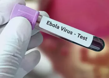 ظهور فيروس إيبولا فى إسرائيل