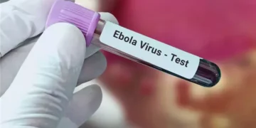 ظهور فيروس إيبولا فى إسرائيل